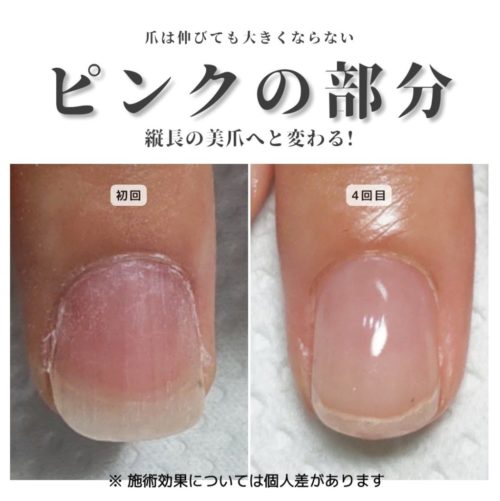 04-2　ひと肌色育成　育成前・結果